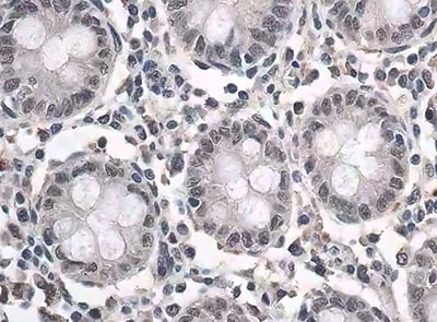 Human IL‑6 Antibody MAB2061