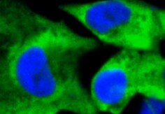 Human/Rat/Chicken Laminin S Antibody MAB2066