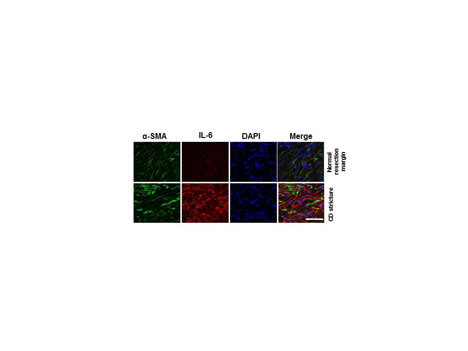Human/Primate IL‑6 Antibody MAB206