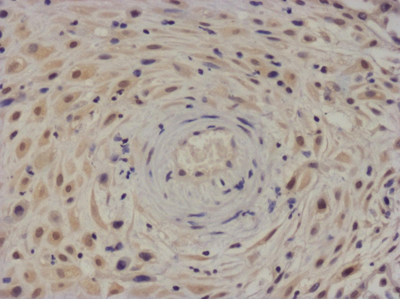Human/Primate IL‑6 Antibody MAB206