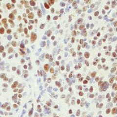 Human/Primate IL‑6 Antibody MAB206