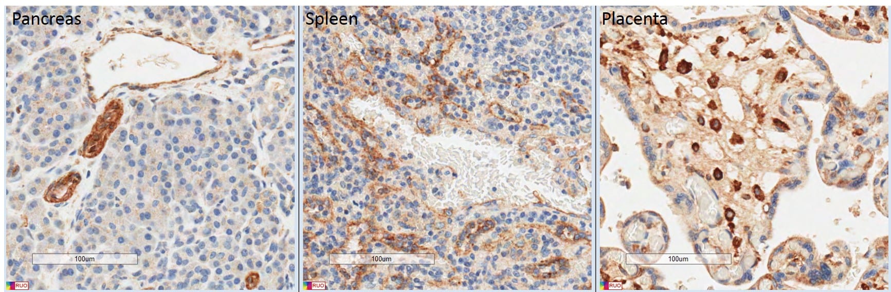 Human LYVE‑1 Antibody MAB20892