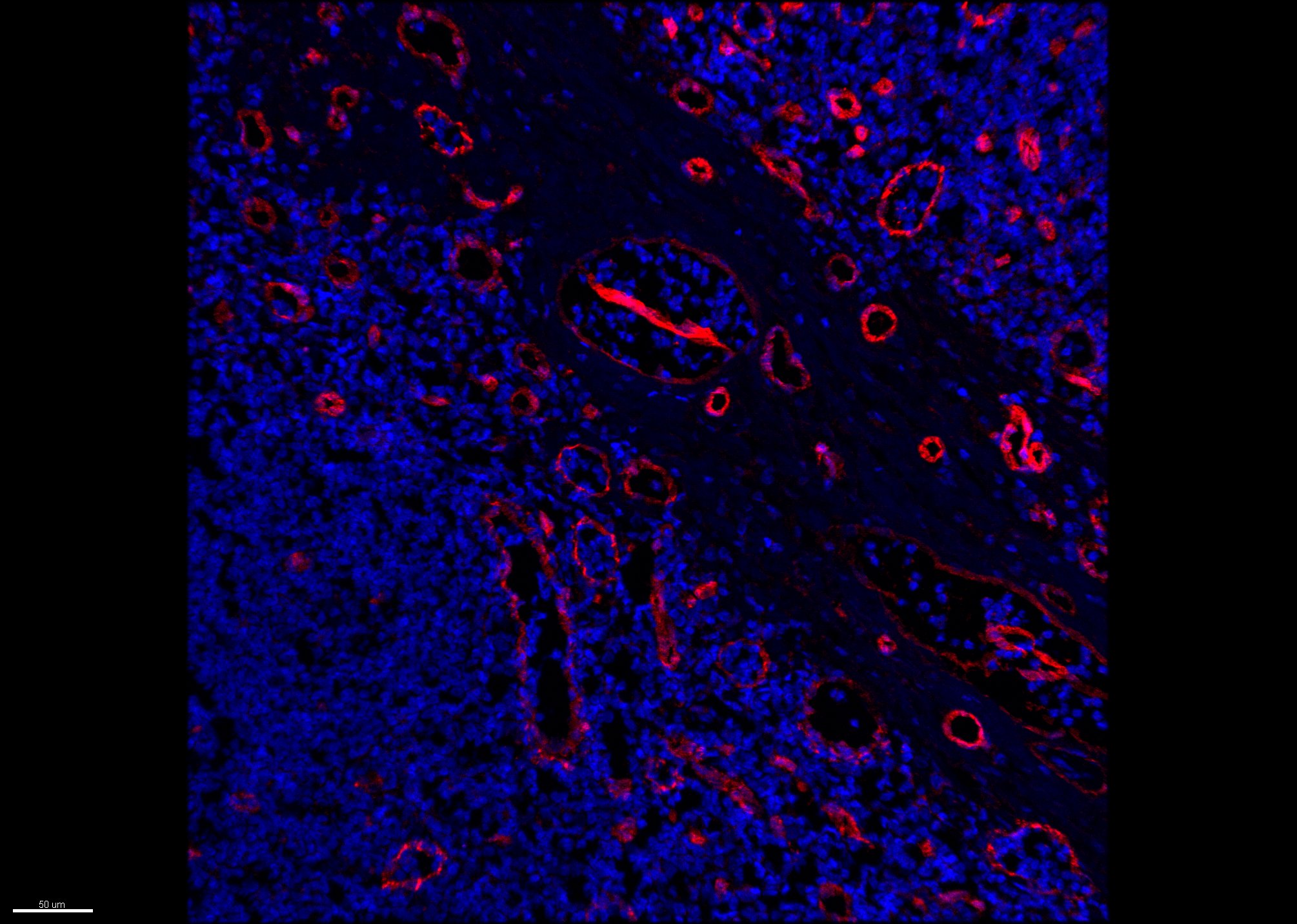 Human LYVE‑1 Antibody MAB20892