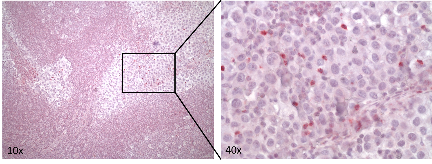 Human IL-8/CXCL8 Antibody MAB208