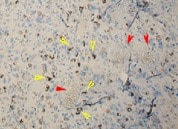 Human IL-8/CXCL8 Antibody MAB208