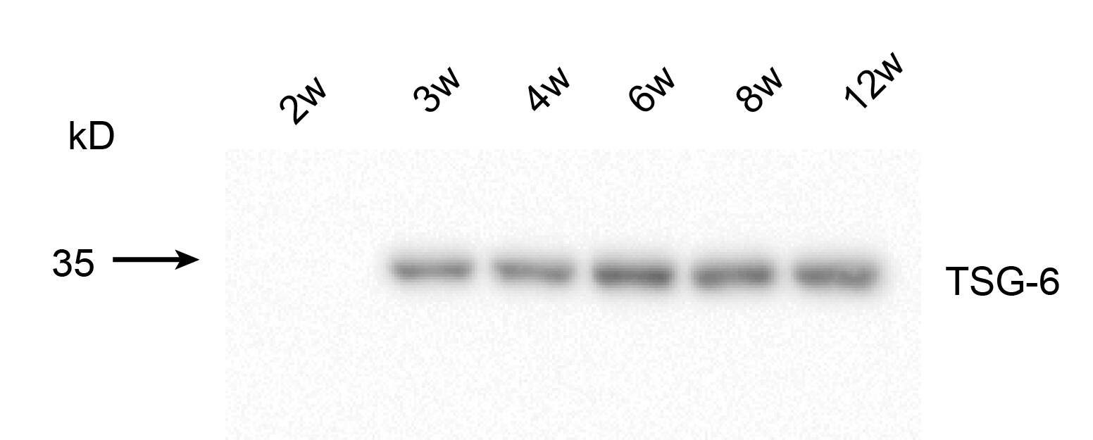 Human/Mouse TSG‑6 Antibody MAB2104