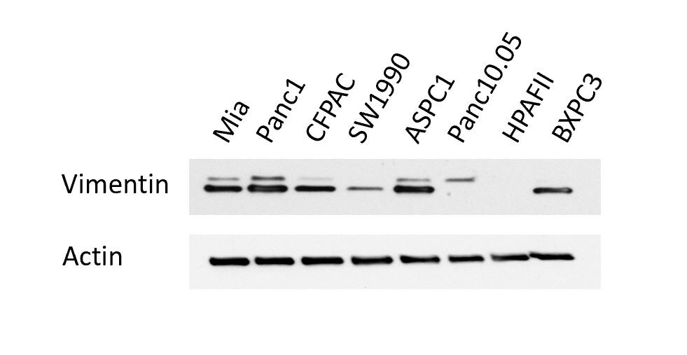Human/Mouse/Rat Vimentin Antibody MAB21052