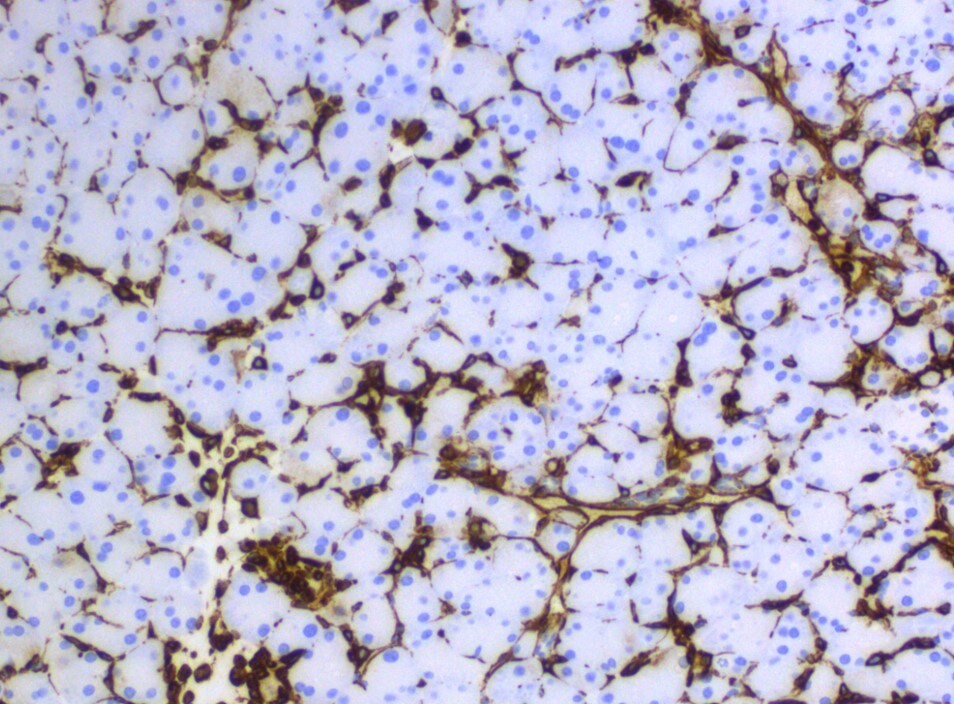 Human/Mouse/Rat Vimentin Antibody MAB21052