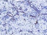 Human/Mouse/Rat Vimentin Antibody MAB21052