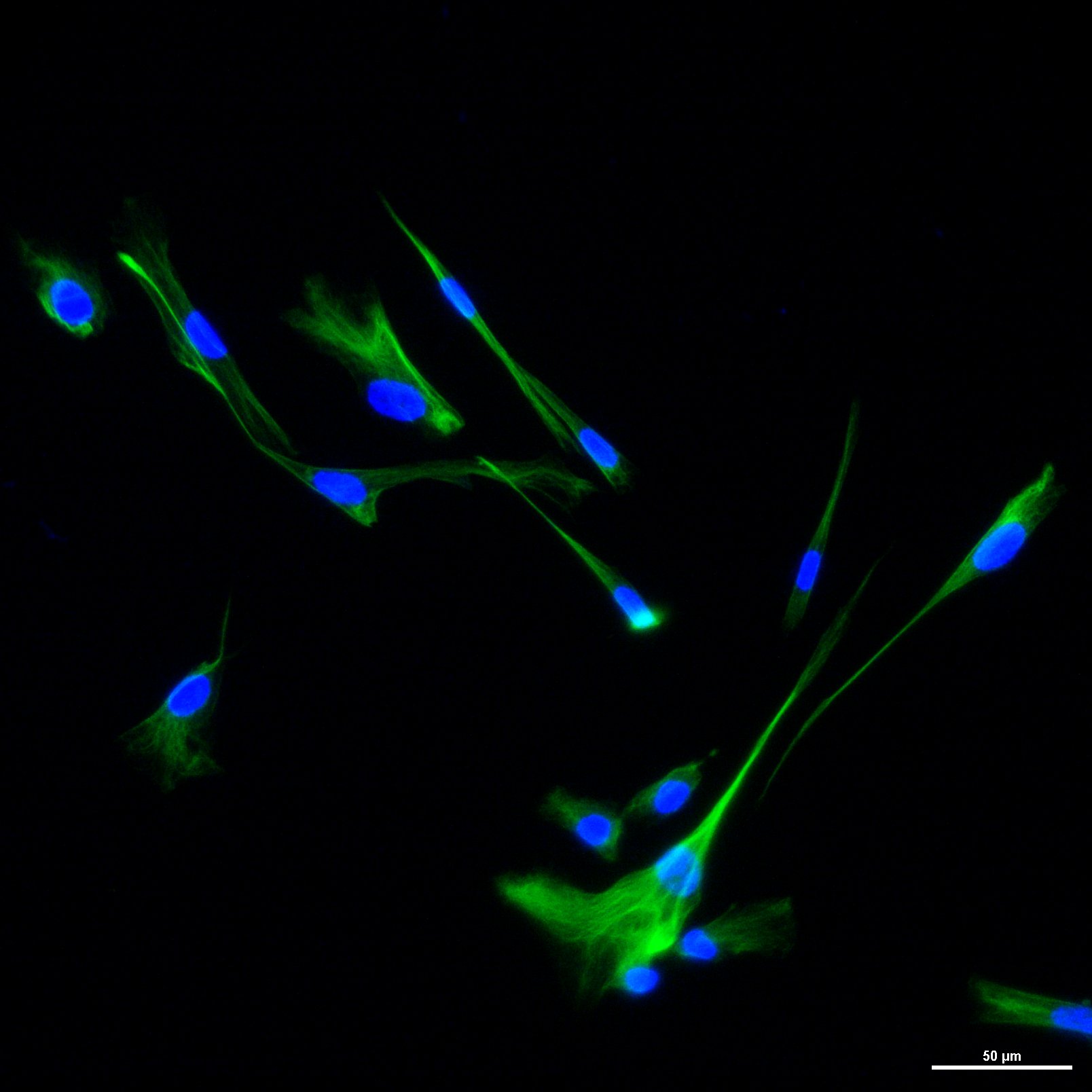 Human/Mouse/Rat Vimentin Antibody MAB2105