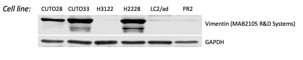 Human/Mouse/Rat Vimentin Antibody MAB2105
