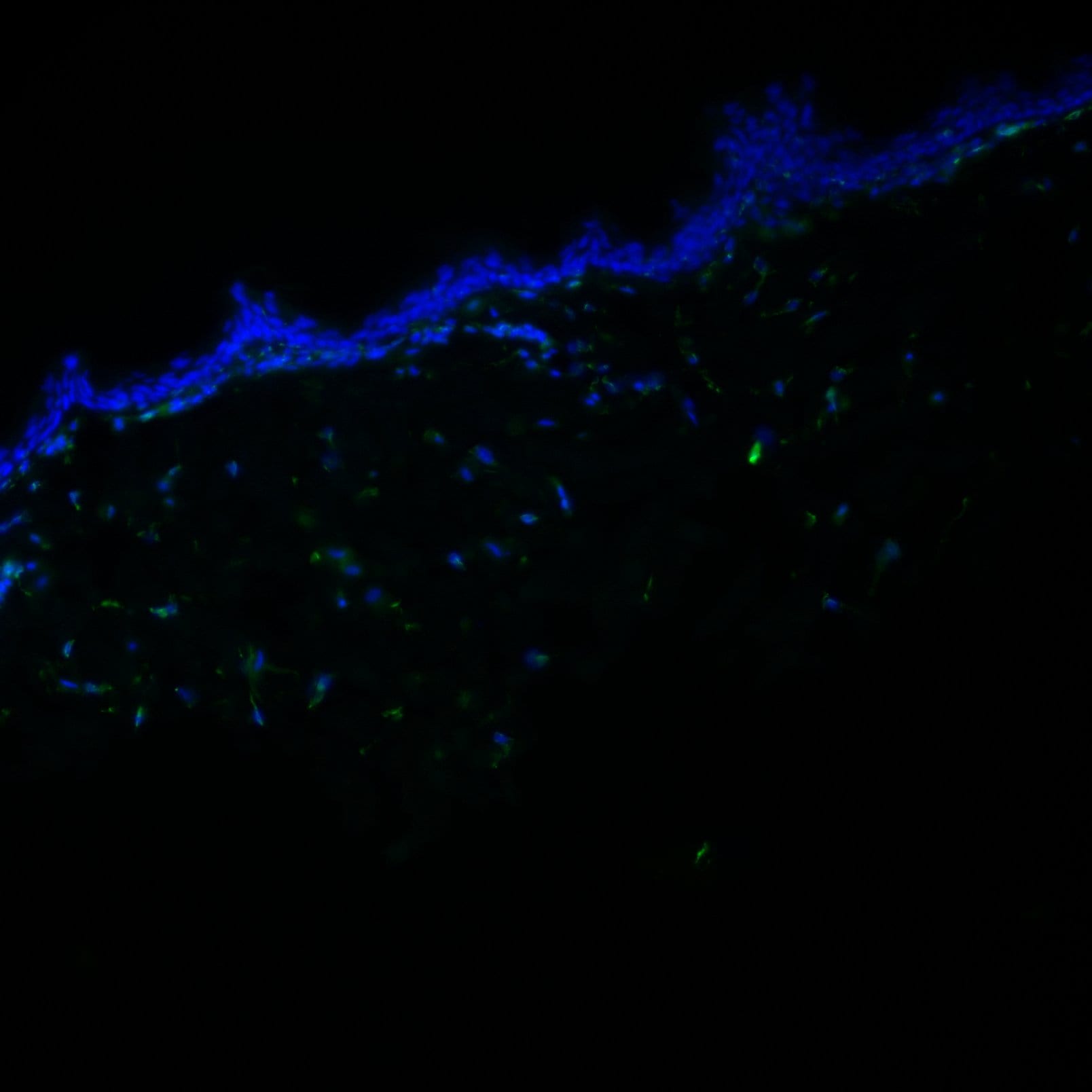 Human/Mouse/Rat Vimentin Antibody MAB2105