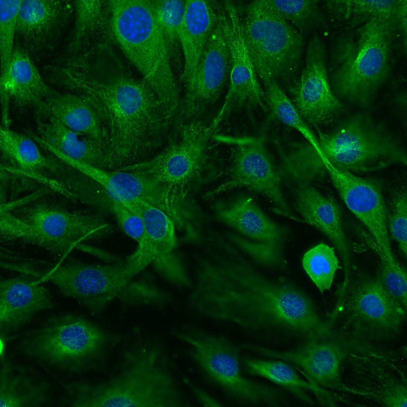 Human/Mouse/Rat Vimentin Antibody MAB2105
