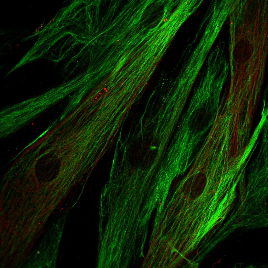 Human/Mouse/Rat Vimentin Antibody MAB2105
