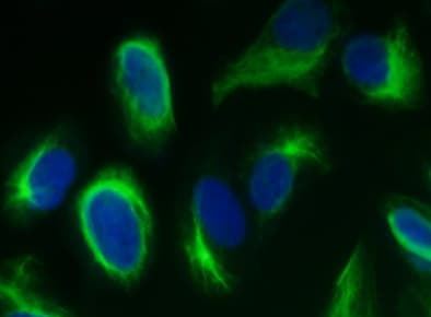 Human/Mouse/Rat Vimentin Antibody MAB2105