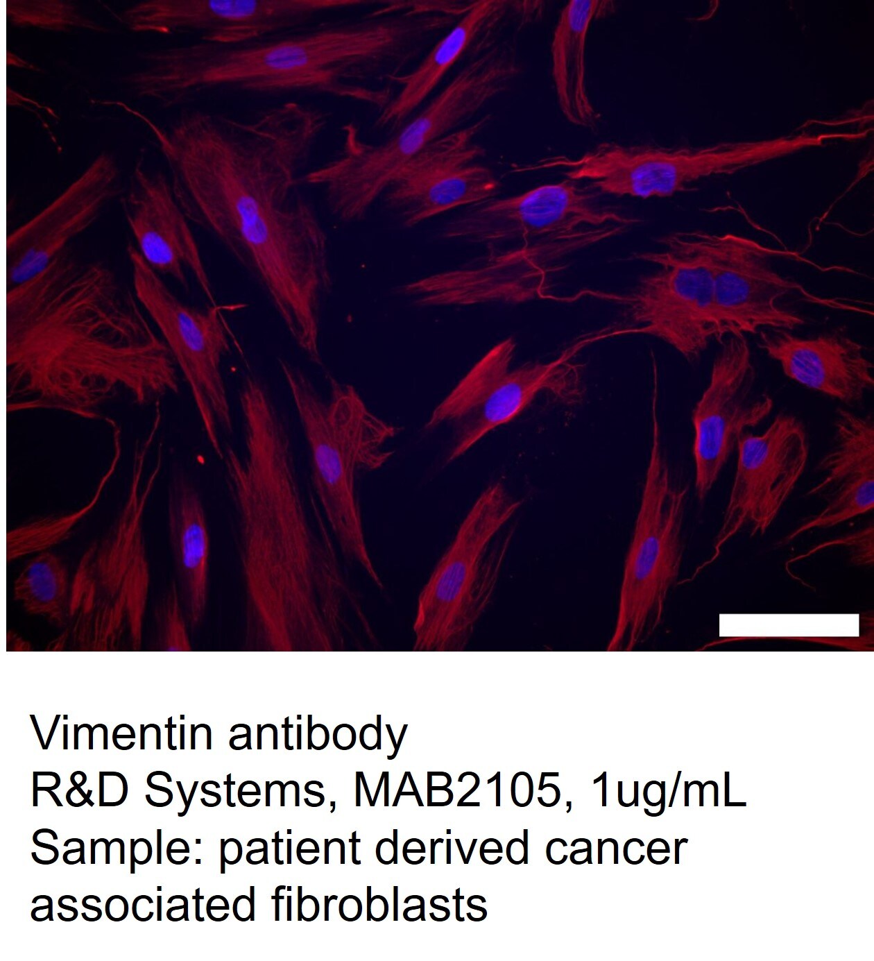 Human/Mouse/Rat Vimentin Antibody MAB2105
