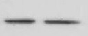 Human/Mouse/Rat Glypican 3 Antibody MAB2119