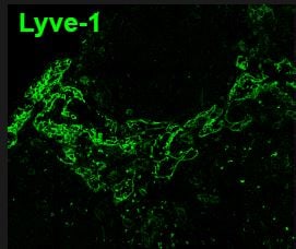 Mouse LYVE‑1 Antibody MAB2125