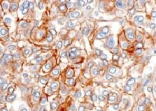 Human CHL‑1/L1CAM‑2 Antibody MAB2126