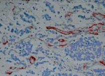 Human/Mouse Tenascin C Antibody MAB2138