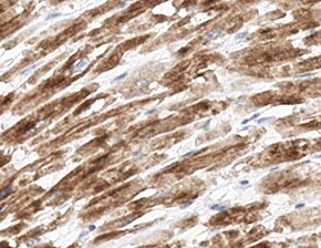 Human Laminin alpha 2 Antibody MAB2143