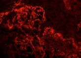Human Laminin  alpha 3/Laminin‑5 Antibody MAB21441
