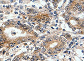 Human Laminin  alpha 3/Laminin‑5 Antibody MAB21441
