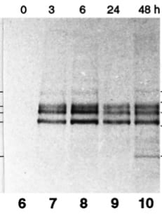 Human Laminin  alpha 3/Laminin‑5 Antibody MAB2144