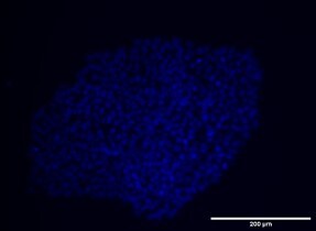 Human/Mouse SSEA‑1 Antibody MAB2155