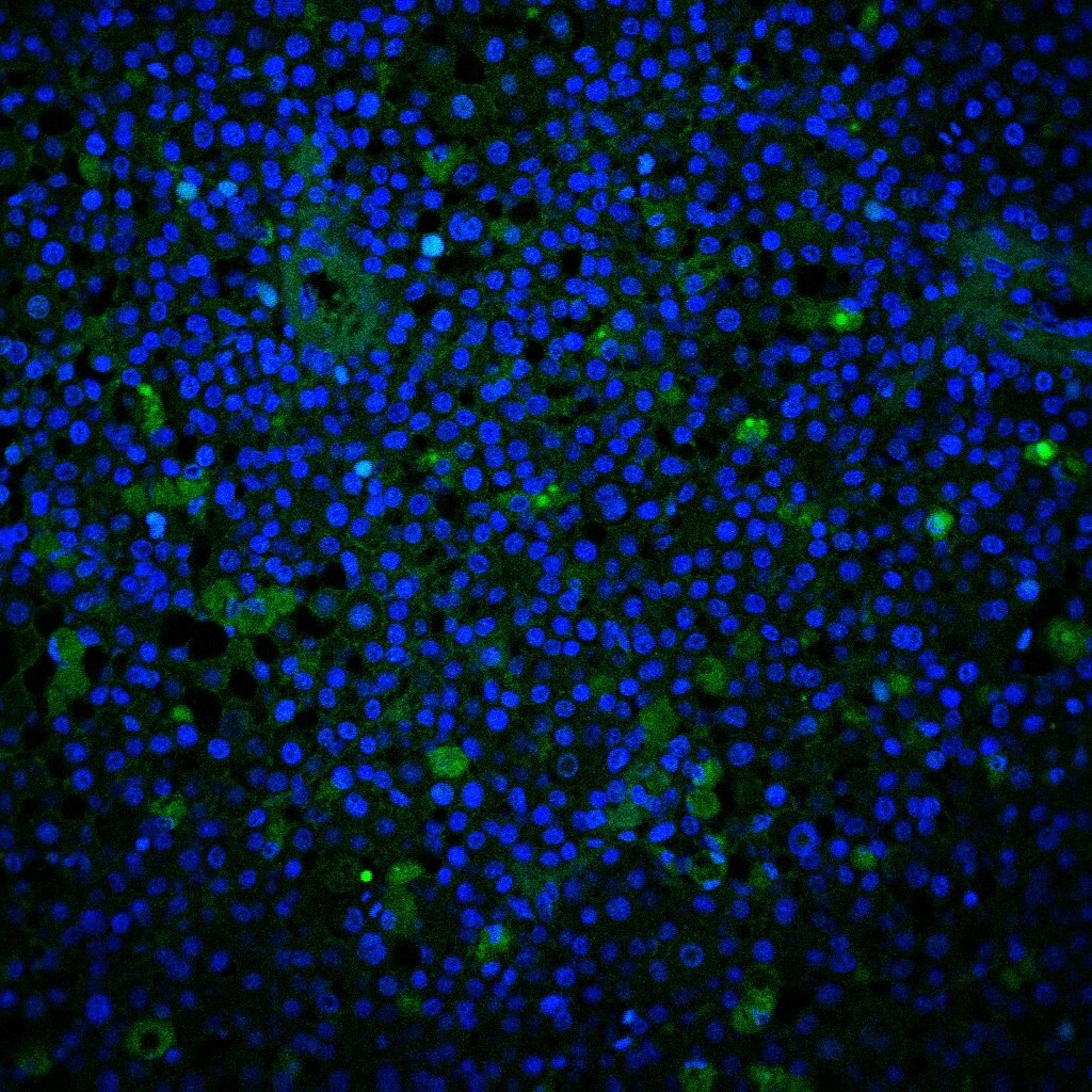 Human GM‑CSF Antibody MAB215