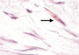 Mouse CXCR2/IL-8RB Antibody MAB2164