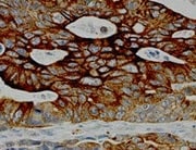 Human Carbonic Anhydrase IX/CA9 Antibody MAB21881