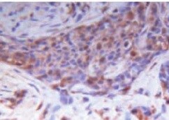 Human BRCA1 C-Terminus Antibody MAB22101