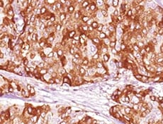 Human BRCA1 C-Terminus Antibody MAB22101