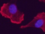 Human NF‑L Antibody MAB22162