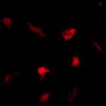 Human Cadherin‑12 Antibody MAB2240