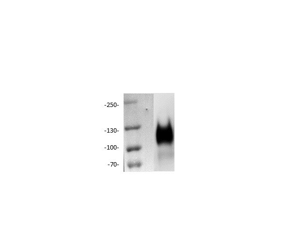Human CEACAM‑1/CD66a Antibody MAB22441