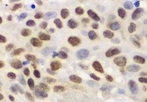Human/Mouse/Rat p27/Kip1 Antibody MAB22561