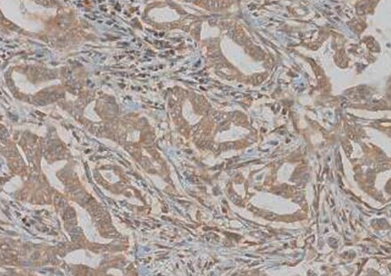 Human Pro-BMP‑2 Antibody MAB2260