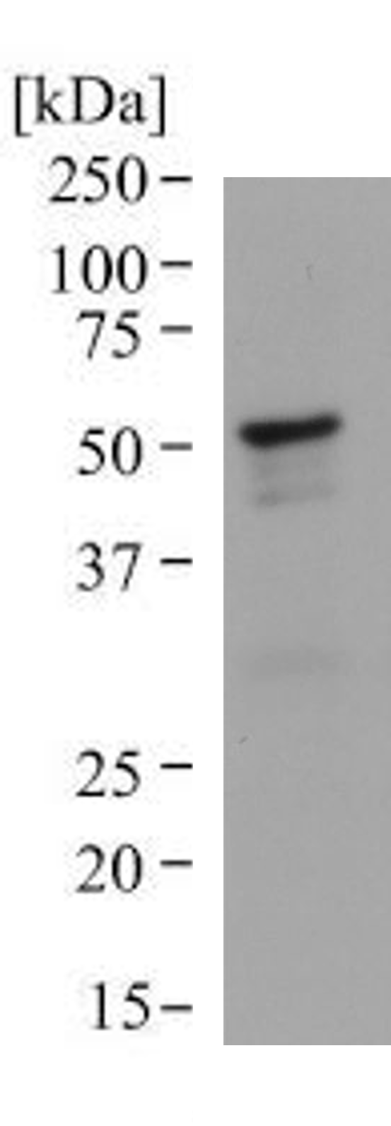 Human IL-6R alpha Antibody MAB227