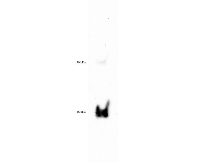 Human IL‑36 gamma /IL‑1F9 Antibody MAB2320
