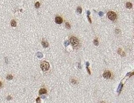 Human FGF acidic/FGF1 Antibody MAB2321