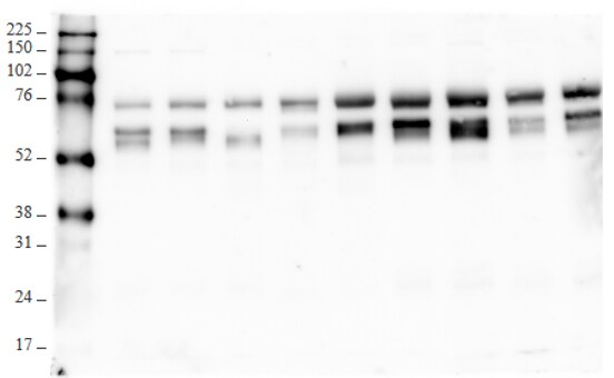 Human Vitronectin Antibody MAB2349