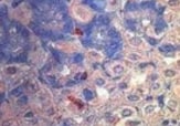 Human/Mouse Somatostatin Antibody MAB2358