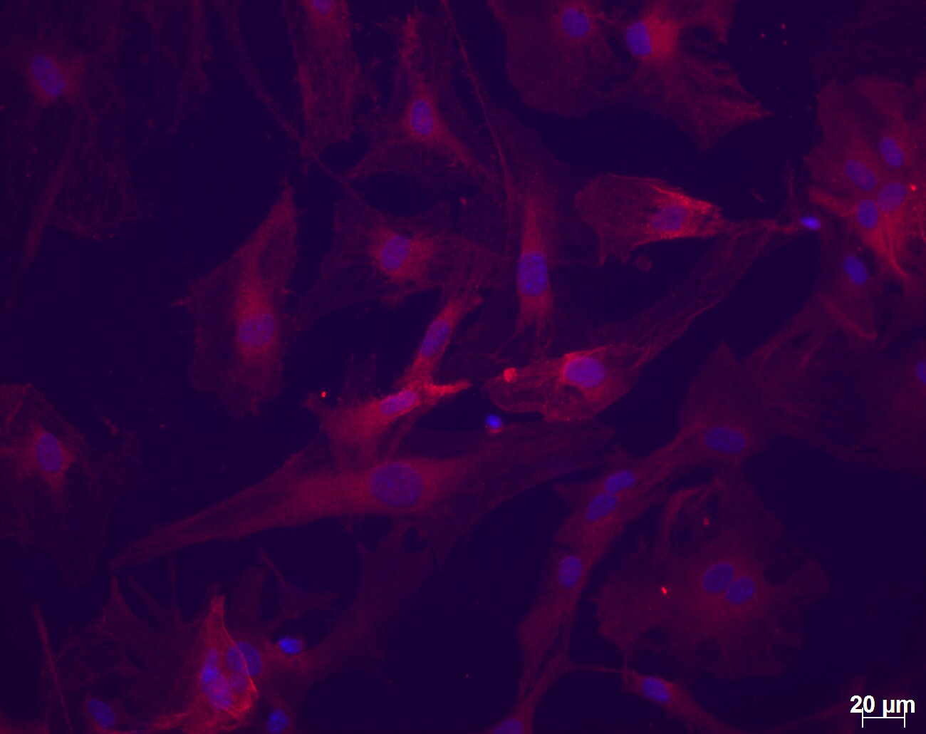 Human/Mouse AMIGO2 Antibody MAB2374