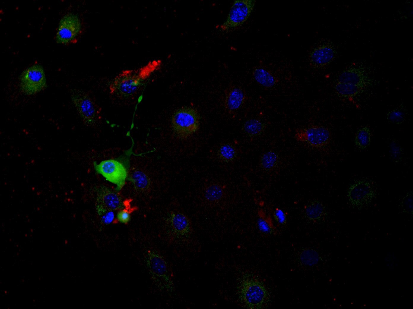Mouse Integrin  beta 1/CD29 Antibody MAB2405