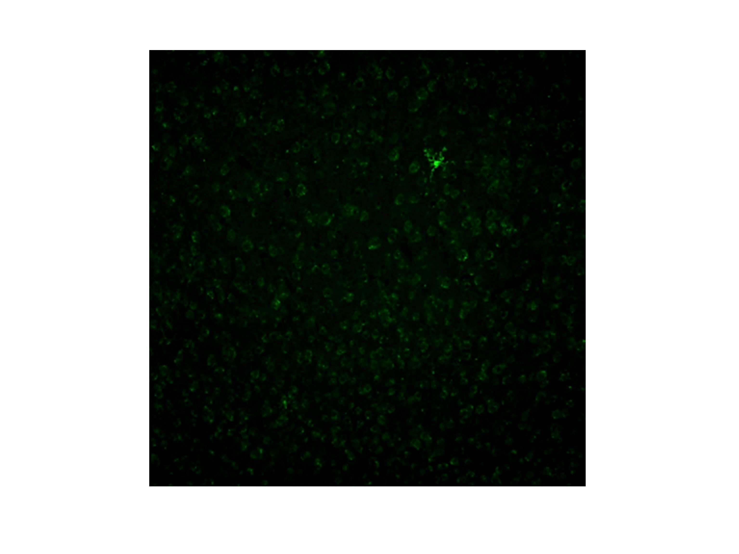 TGF‑ beta 1 Antibody MAB240