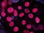Human/Mouse PDX‑1/IPF1 Antibody MAB2419