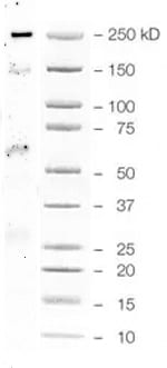 Human/Mouse PDX‑1/IPF1 Antibody MAB2419