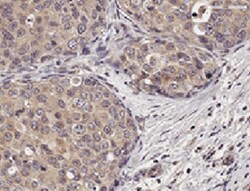 Human Progranulin/PGRN Antibody MAB24201